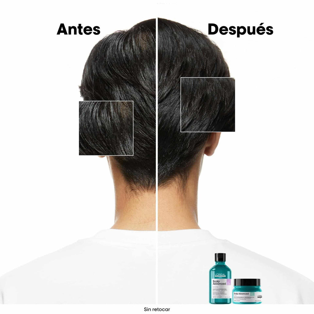 Shampoo anti-grasa Scalp Advanced