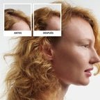 Kit Engrosador y Fortalecedor para Cabello Fino y Debilitado