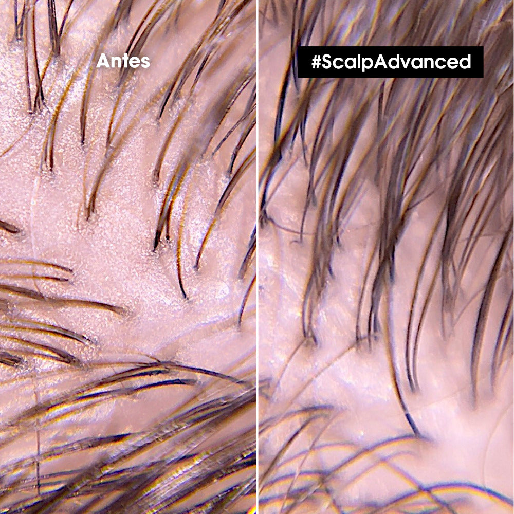 Arcilla capilar anti-grasa Scalp Advanced