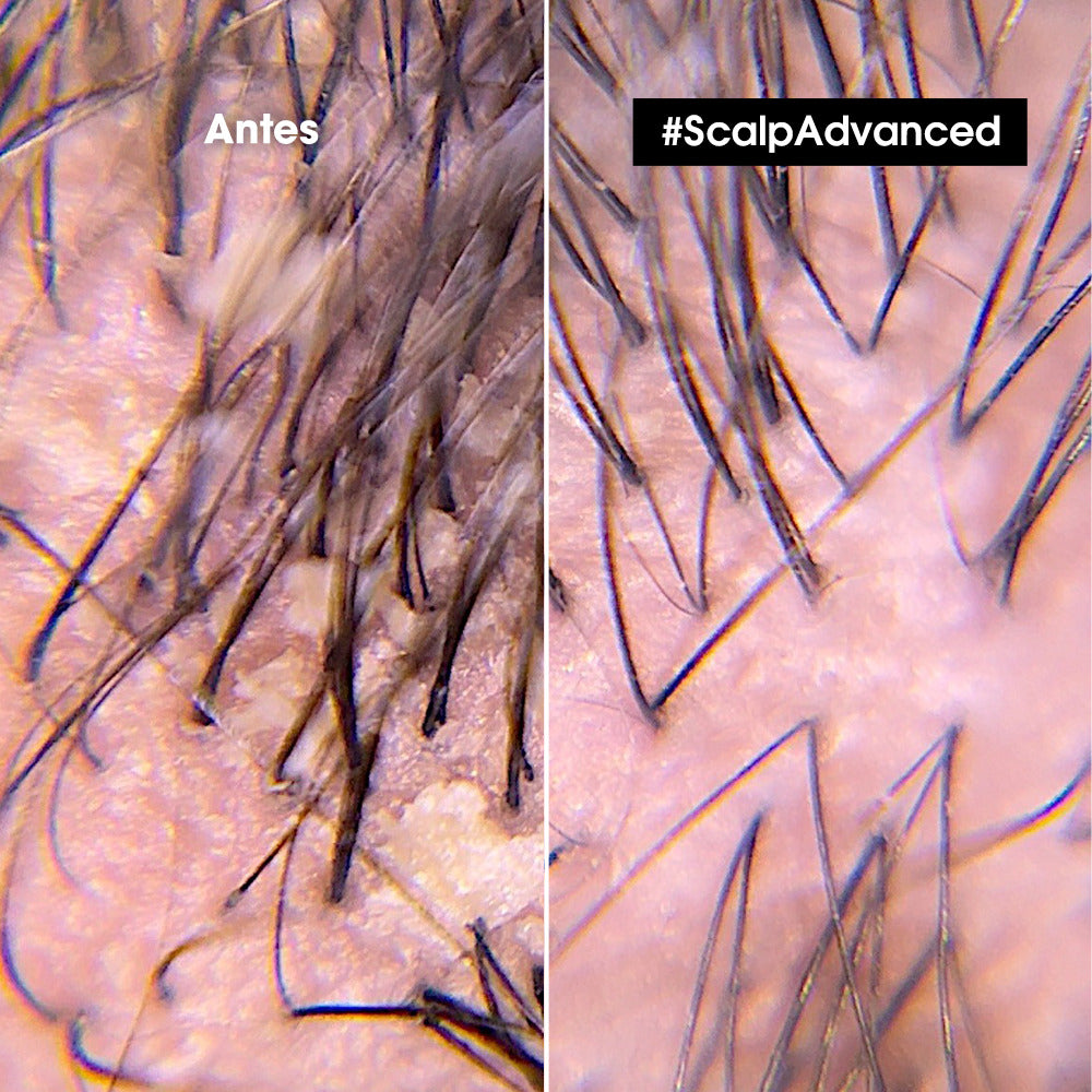 Shampoo anti-grasa Scalp Advanced olamine