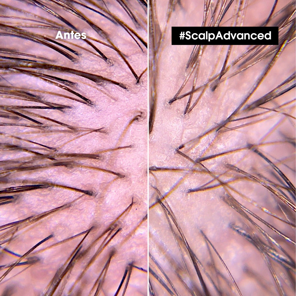 Calmante capilar anti-grasa Scalp Advanced