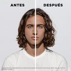Shampoo anti-caida Hombre